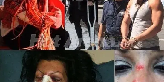 Миски и певици жертви на гаджета: Жана и Сани Алекса посинени от бой, краката на Деси Зидарова строшени с бухалка, Катрин Вачева със счупен нос