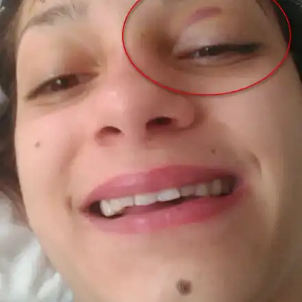 Млада бургазлийка ридае: Синът на Найден Милков ме смля от бой, страхувам се за живота си!