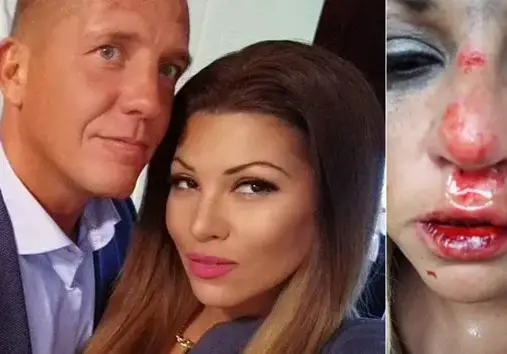 Пълен ОБРАТ! Гаджето на Сани Алекса: Не съм я пребил, тя падна по стълбите, сега ме изнудва за пари! (ВИЖТЕ разказа на шведа)