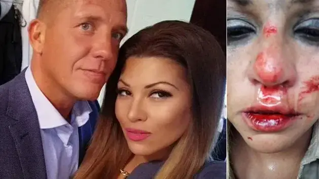 Пълен ОБРАТ! Гаджето на Сани Алекса: Не съм я пребил, тя падна по стълбите, сега ме изнудва за пари! (ВИЖТЕ разказа на шведа)