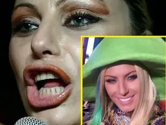 Разкритие на HotArena! Камелия си оправи жълтите зъби и от кеф не спира да се хили! Преди от срам здраво стискаше устни (Снимки)