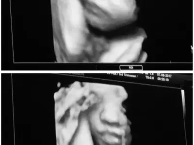 Сървайвърката Янита показа нероденото бебе (Вижте го)