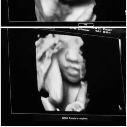 Сървайвърката Янита показа нероденото бебе (Вижте го)