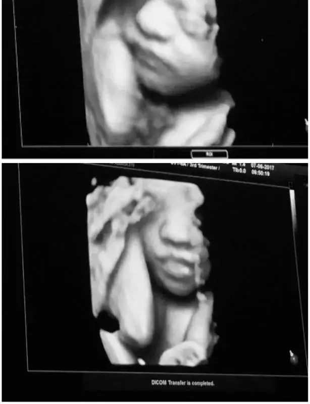 Сървайвърката Янита показа нероденото бебе (Вижте го)