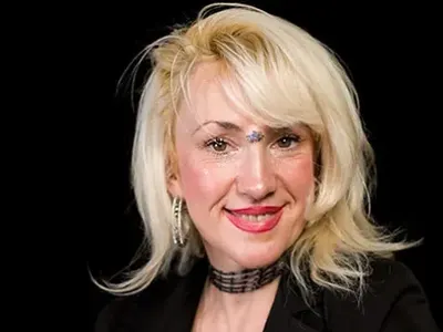 Драма! Сашка Васева напълно сляпа с дясното око! Атрофирал нерв й пречи да вижда