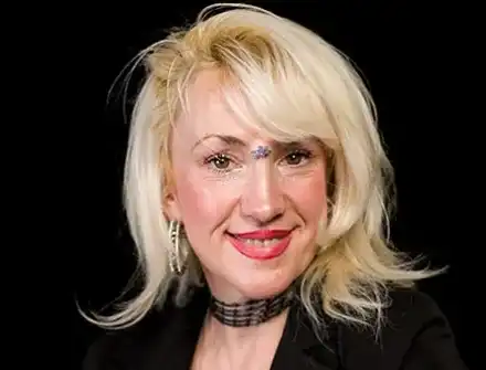 Драма! Сашка Васева напълно сляпа с дясното око! Атрофирал нерв й пречи да вижда