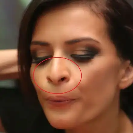 Какво се случва с носа на Преслава? Тотално е деформиран! Вижте версиите за обезобразяването й