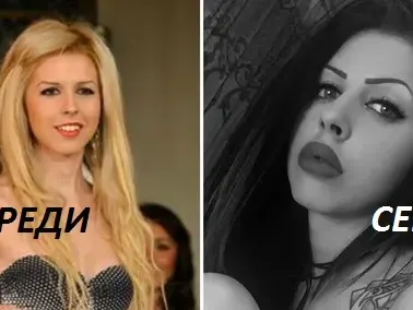 Нищо ново под слънцето! Поредната Мис Силикон 2016 се обезобрази, просто защото така е модерно (За пластиките и да не прилича на себе си е броила 30 бона)