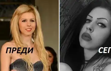 Нищо ново под слънцето! Поредната Мис Силикон 2016 се обезобрази, просто защото така е модерно (За пластиките и да не прилича на себе си е броила 30 бона)