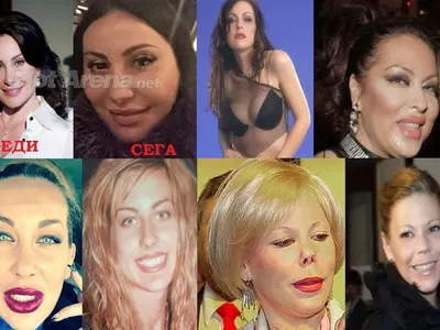 Пластичният ужас на звездите! Дарина Павлова и Княгиня Калина най-големите жертви на скалпела (Вижте и други + СНИМКИ)