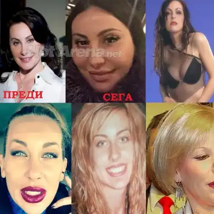 Пластичният ужас на звездите! Дарина Павлова и Княгиня Калина най-големите жертви на скалпела (Вижте и други + СНИМКИ)