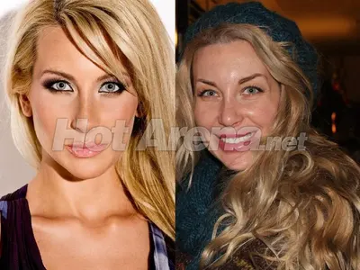 Пластичният ужас на звездите! Дарина Павлова и Княгиня Калина най-големите жертви на скалпела (Вижте и други + СНИМКИ)