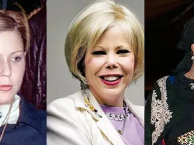 Пластичният ужас на звездите! Дарина Павлова и Княгиня Калина най-големите жертви на скалпела (Вижте и други + СНИМКИ)