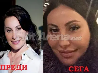 Пластичният ужас на звездите! Дарина Павлова и Княгиня Калина най-големите жертви на скалпела (Вижте и други + СНИМКИ)