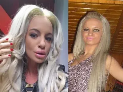 Пластичният ужас на звездите! Дарина Павлова и Княгиня Калина най-големите жертви на скалпела (Вижте и други + СНИМКИ)