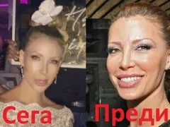 Ирен Онтева остана без нос! Какво се е случило с моделката? (СНИМКИ преди и сега)