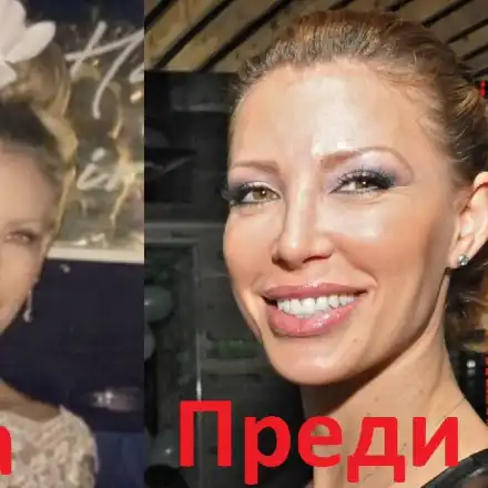 Ирен Онтева остана без нос! Какво се е случило с моделката? (СНИМКИ преди и сега)