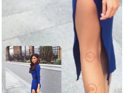 Мегз със синини по краката - бита ли e? (СНИМКИ)