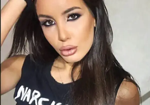 Ужас! Хирург окепази лицето на Адриана Тюркмен