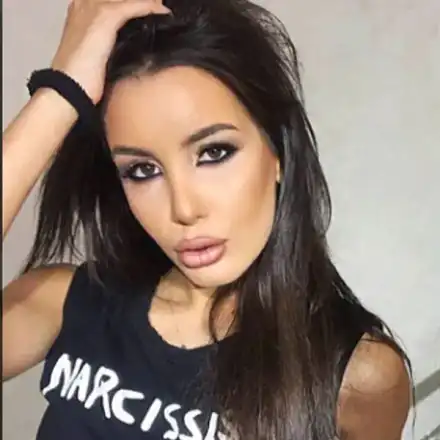 Ужас! Хирург окепази лицето на Адриана Тюркмен