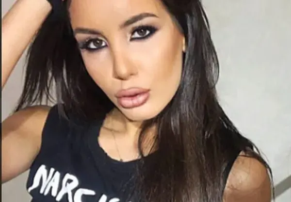 Ужас! Хирург окепази лицето на Адриана Тюркмен