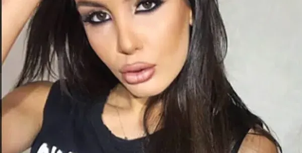 Ужас! Хирург окепази лицето на Адриана Тюркмен