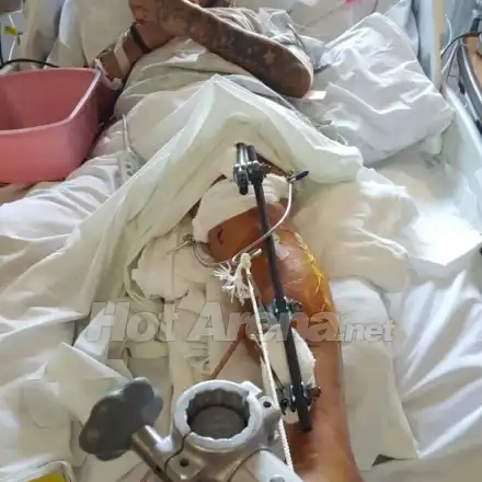 9-те живота на Джино: Брадърът е с 20 операции след побой и катастрофа! Хирурзи възстановявали главата му по снимка