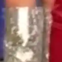 Синини по краката на Галена! Бита ли е, или раните са след хард изпълнение? Версии и снимки