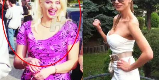 Зорница Линдарева 17 години обикаляла психиатрите, за да бори с булимията! Баджаначката на Калканджиева тежала 90 кила  (Шокиращи подробности)