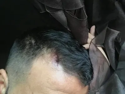 Азис пее с разцепена глава на участие