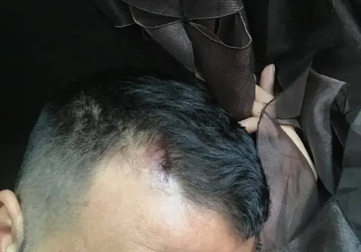 Азис пее с разцепена глава на участие