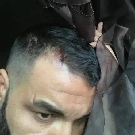 Азис пее с разцепена глава на участие