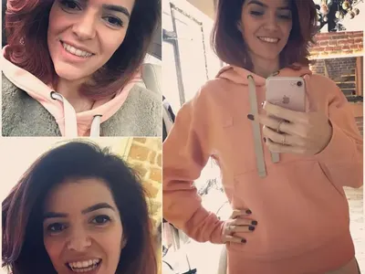 Ива Софиянска подравни зъбите си и се похвали на всички (Ето резултата)