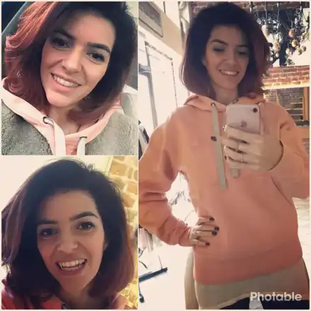 Ива Софиянска подравни зъбите си и се похвали на всички (Ето резултата)