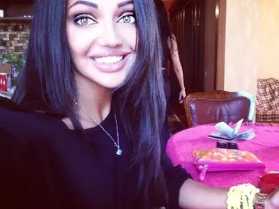 Есмер си ремонтира зъбите и заприлича на кон