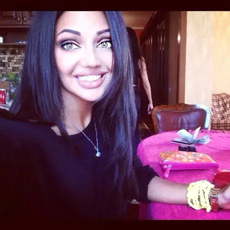 Есмер си ремонтира зъбите и заприлича на кон