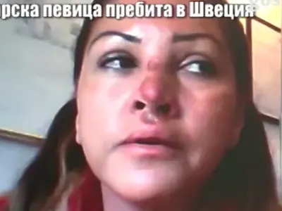 Ето какво прави сега пребитата Сани Алекса! Вече се възстанови, намрази мъжете и премина на жени (ФОТО ФАКТ)