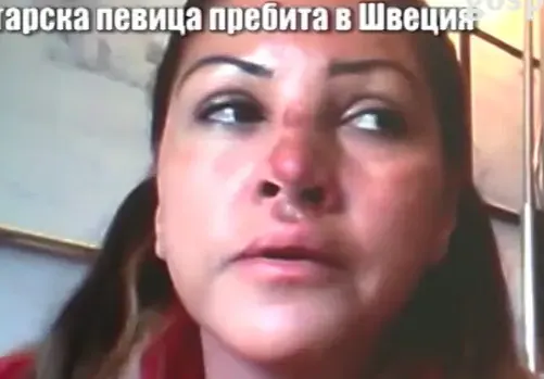Ето какво прави сега пребитата Сани Алекса! Вече се възстанови, намрази мъжете и премина на жени (ФОТО ФАКТ)
