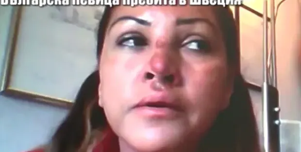 Ето какво прави сега пребитата Сани Алекса! Вече се възстанови, намрази мъжете и премина на жени (ФОТО ФАКТ)