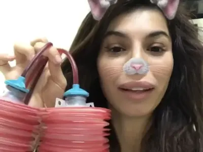 Мегз проговори след операцията