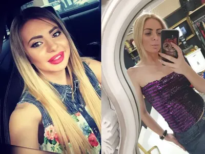 Защо Мис Силикон Габриела Попова отслабна с 12 кг? Подозират АНОРЕКСИЯ! (Снимки преди и сега)