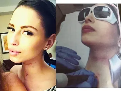 Цвети Стоянова изтри белезите от инцидента с поредица от операции! (Подробности)