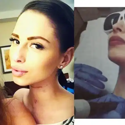 Цвети Стоянова изтри белезите от инцидента с поредица от операции! (Подробности)