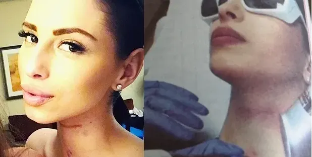 Цвети Стоянова изтри белезите от инцидента с поредица от операции! (Подробности)