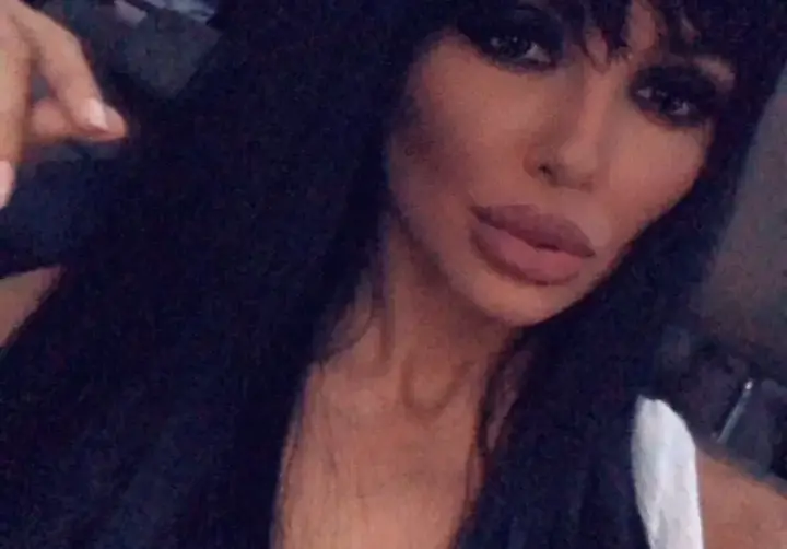 Николета напомпа устните, сложи си хиалуронови филъри