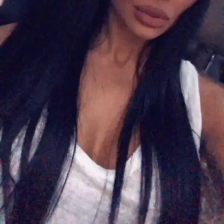 Николета напомпа устните, сложи си хиалуронови филъри