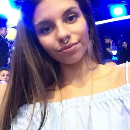 Дивна осакати приятелка в катастрофа, ампутират краката й