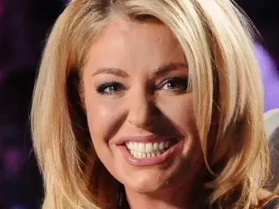 Хилда не ще операции, а ботокс