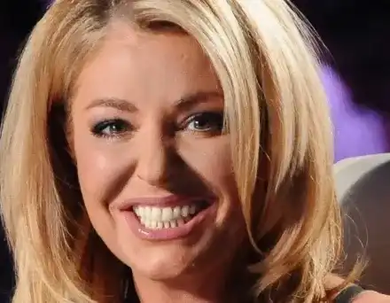 Хилда не ще операции, а ботокс