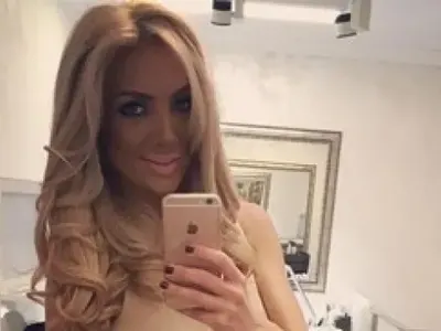 Златка Райкова пъпчаса oт солариум